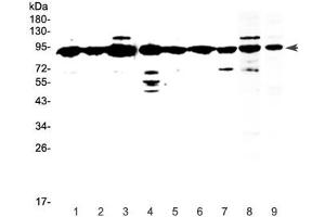 Western blot testing of human 1) HeLa, 2) placenta, 3) MCF7, 4) HepG2, 5) A549, 6) SKOV3, 7) PANC-1 and 8) mouse testis and 9) rat testis lysate with XRCC1 antibody at 0. (XRCC1 anticorps)