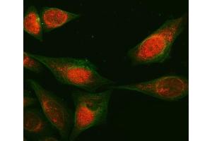 IF analysis of RAB3GAP1 using anti-RAB3GAP1 antibody (ABIN7599702) and Anti-Beta Tubulin Antibody (ABIN7602743). (RAB3GAP1 anticorps  (AA 109-810))