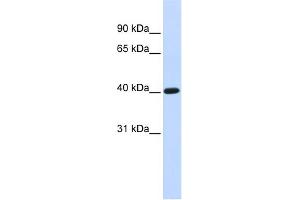 WB Suggested Anti-TFB1M Antibody Titration:  0. (TFB1M anticorps  (N-Term))