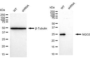 Western blotting analysis using NQO2 antibody (ABIN7799626).