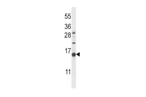 NPPC anticorps  (C-Term)