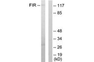 Western blot analysis of extracts from HuvEc cells, using FIR Antibody. (FARP2 anticorps  (AA 331-380))