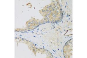 Immunohistochemistry of paraffin-embedded human prostate using LLGL2 antibody at dilution of 1:200 (40x lens). (LLGL2 anticorps)
