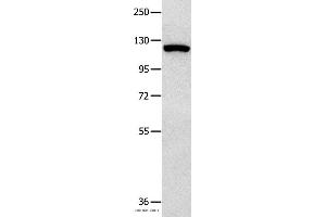 Western blot analysis of 823 cell , using MVP Polyclonal Antibody at dilution of 1:350 (MVP anticorps)