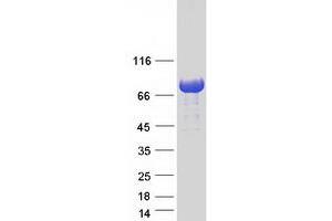 Validation with Western Blot