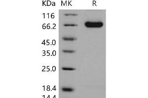 Western Blotting (WB) image for delta-Like 4 (DLL4) (Active) protein (His tag) (ABIN7320207)