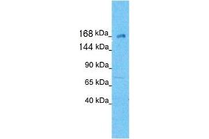 Western Blotting (WB) image for anti-Kinesin Family Member 21A (KIF21A) (N-Term) antibody (ABIN182908) (KIF21A anticorps  (N-Term))