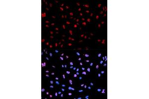 Immunofluorescence analysis of U2OS cell using Phospho-MEF2C-S396 antibody.
