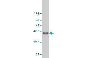 Western Blot detection against Immunogen (36. (Exportin 2 anticorps  (AA 872-971))