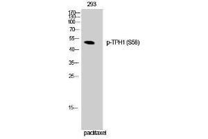 Western Blotting (WB) image for anti-Tryptophan Hydroxylase 1 (TPH1) (pSer58) antibody (ABIN3182629) (Tryptophan Hydroxylase 1 anticorps  (pSer58))