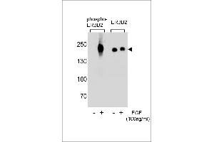 Western blot analysis of extracts from A431 cells,untreated or treated with EGF,100 ng/mL , using phospho-ERBB2-p(L)(left) or ERBB2 Antibody (right) (ErbB2/Her2 anticorps  (pTyr1248))