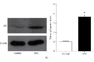 Results of p21 gene expression in the glomeruli of type 1 diabetic rats.
