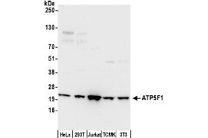 Western Blotting (WB) image for anti-ATP Synthase, H+ Transporting, Mitochondrial Fo Complex, Subunit B1 (ATP5F1) (AA 25-75) antibody (ABIN7450009)