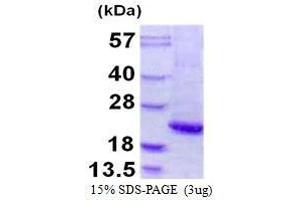 Figure annotation denotes ug of protein loaded and % gel used. (Orosomucoid 1 (ORM1) (AA 19-201) Peptide)