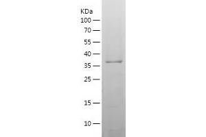 Western Blotting (WB) image for DPH1 Homolog (DPH1) (AA 89-239) protein (His-IF2DI Tag) (ABIN7122704)