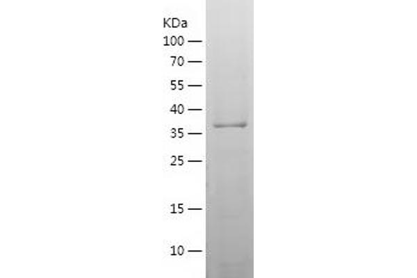 DPH1 Protein (AA 89-239) (His-IF2DI Tag)