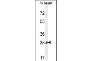 B3GAT2 anticorps  (AA 123-150)