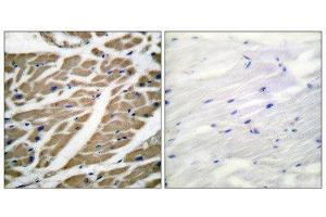 anti-Sodium Channel (Internal Region), (pan) antibody