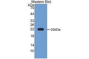 Detection of Recombinant MFAP2, Human using Polyclonal Antibody to Microfibrillar Associated Protein 2 (MFAP2)