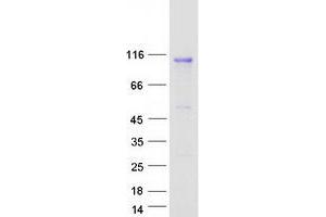 Validation with Western Blot (IL17RD Protein (Myc-DYKDDDDK Tag))