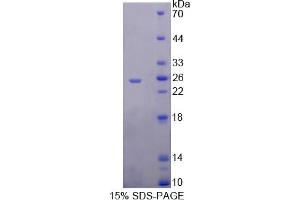Image no. 1 for Ribonuclease, RNase A Family, 9 (Non-Active) (RNASE9) (AA 28-210) protein (His tag) (ABIN6238220) (RNASE9 Protein (AA 28-210) (His tag))
