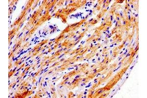 Immunohistochemistry of paraffin-embedded human heart tissue using ABIN7165855 at dilution of 1:100