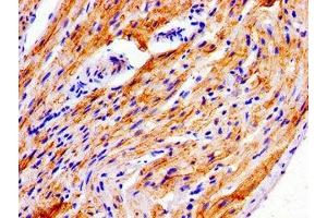 Immunohistochemistry of paraffin-embedded human heart tissue using ABIN7165855 at dilution of 1:100 (NDRG4 anticorps  (AA 210-331))
