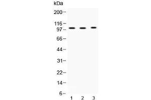 Western blot testing of 1) rat testis, 2) mouse testis and 3) MCF7 lysate with ADAM2 antibody at 0. (ADAM2 anticorps  (AA 231-274))