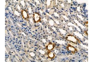 AQP2 Mouse Monoclonal Antibody at 1/100 staining rat kidney tissue by IHC-P.