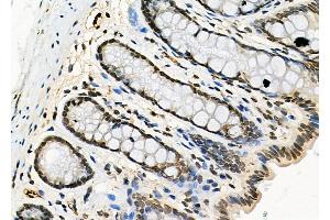 ABIN6260852 and ABIN6277771 at 1/100 staining Rat stomach tissue by IHC-P. (CSNK2A1/CK II alpha anticorps  (N-Term))