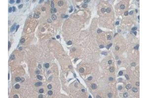 Detection of EZR in Human Stomach Tissue using Polyclonal Antibody to Ezrin (EZR)