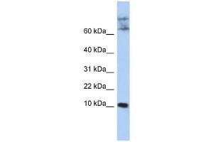 CKLF antibody used at 1 ug/ml to detect target protein. (CKLF anticorps  (N-Term))