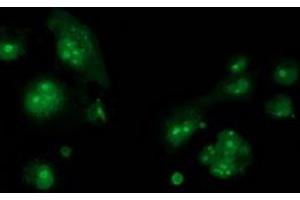 Anti-CDCP1 mouse monoclonal antibody (ABIN2454046) immunofluorescent staining of COS7 cells transiently transfected by pCMV6-ENTRY CDCP1 (RC220633). (CDCP1 anticorps)