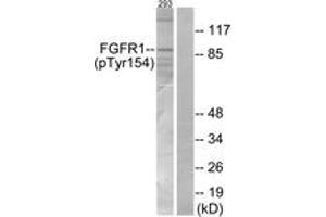 Western blot analysis of extracts from 293 cells, using FGFR1 (Phospho-Tyr154) Antibody.