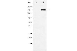 Western blot analysis of ASK1 phosphorylation expression in TNF-α treated MDA-MB-435 whole cell lysates,The lane on the left is treated with the antigen-specific peptide.