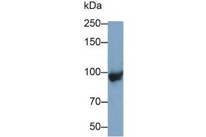 Detection of C4B in Mouse Placenta lysate using Polyclonal Antibody to Complement C4-B (C4B) (C4B anticorps  (AA 126-366))