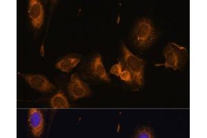 Immunofluorescence analysis of U-2 OS cells using RPL32 Polyclonal Antibody at dilution of 1:100 (40x lens). (RPL32 anticorps)