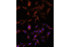 Immunofluorescence analysis of C6 cells using TBCC antibody (ABIN7271029) at dilution of 1:100.