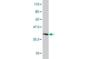 Western Blot detection against Immunogen (37.