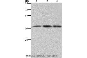 Western blot analysis of 293T and LoVo cell, human brain malignant glioma tissue, using CAB39 Polyclonal Antibody at dilution of 1:450 (CAB39 anticorps)