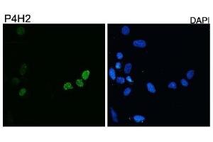 Diluted 1:10,000 on rhabdomyosarcoma cell line RD transfected with pCS2-DUX4. (DUX4 anticorps  (C-Term))
