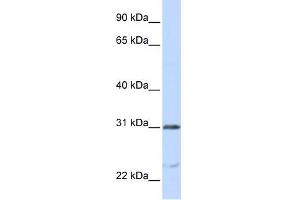 NUSAP1 antibody used at 1 ug/ml to detect target protein. (NUSAP1 anticorps  (C-Term))