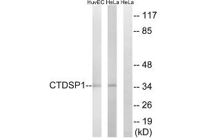 Western blot analysis of extracts from HUVEC cells and HeLa cells, using CTDSP1 antibody.