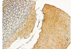 ABIN6258450 and ABIN6275840 at 1/100 staining Rat stomach tissue by IHC-P. (DDR1 anticorps  (Internal Region))
