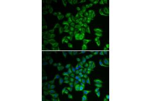 Immunofluorescence analysis of A549 cells using FXN antibody.
