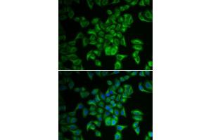 Immunofluorescence analysis of A549 cells using FXN antibody. (Frataxin anticorps  (AA 42-210))