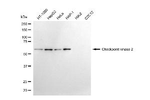 Western blotting analysis using checkpoint kinase 2 antibody (ABIN7798038).
