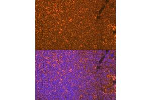 Immunofluorescence analysis of mouse spleen using Oncostatin M Rabbit mAb (ABIN7269099) at dilution of 1:100 (40x lens).