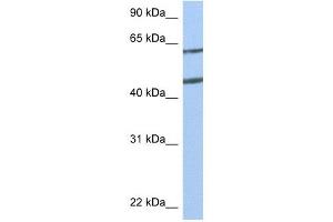 Netrin 4 antibody used at 1 ug/ml to detect target protein. (Netrin 4 anticorps  (N-Term))