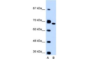 WB Suggested Anti-FN1 Antibody Titration:  0. (Fibronectin 1 anticorps  (C-Term))